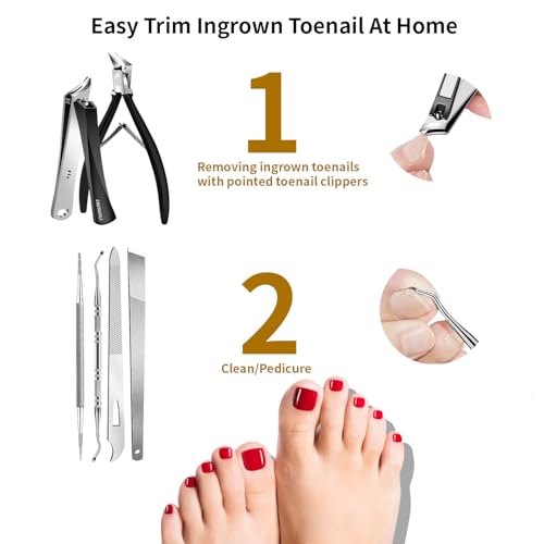 Ingrown Toenail Removal Kit - 6-Piece Professional Pedicure Tools