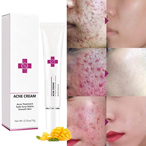 Calming Relief Cream - 8.5 oz / 250 ml - Moisturizing Comfort from Itchy Skin, Helps Alleviate Itch from Eczema, Hives, Sunburn - Vegan Formula with Shea Butter & Tea Tree Oil - by NextGenU