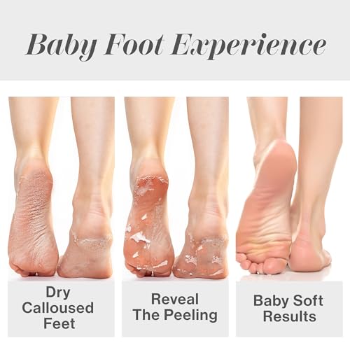 Baby Foot Original Exfoliation Foot Peel - For Rough Cracked, Dry Feet, Dead Skin Removal - Foot Peeling Mask for Baby Soft Feet - Spa Experience at Home & Gift Ideas - Lavender Scented