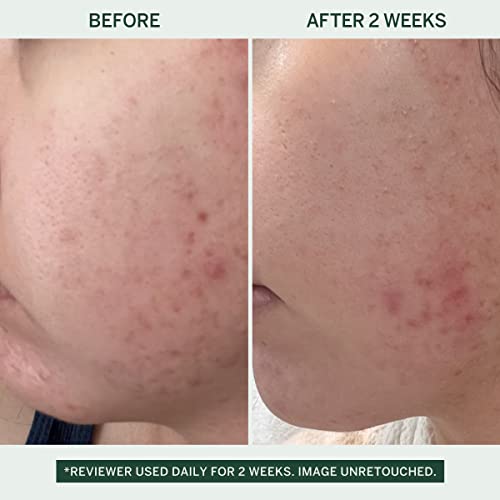 FACETORY Urban Calm Hydrating Vita Serum with Fermented Mung Bean & 10% Niacinamide, Glow Boosting Facial Serum for Women, Brightening, Fine Line & Wrinkle Treatment, Revive & Plump Skin - 30 ml