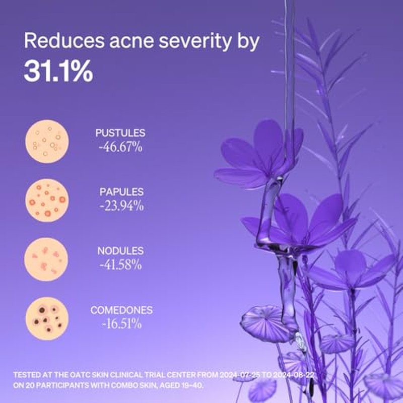 Acne Solution Duo: Soothing Toner & Invisible Spot Patches for Sensitive, Blemish-Prone Skin