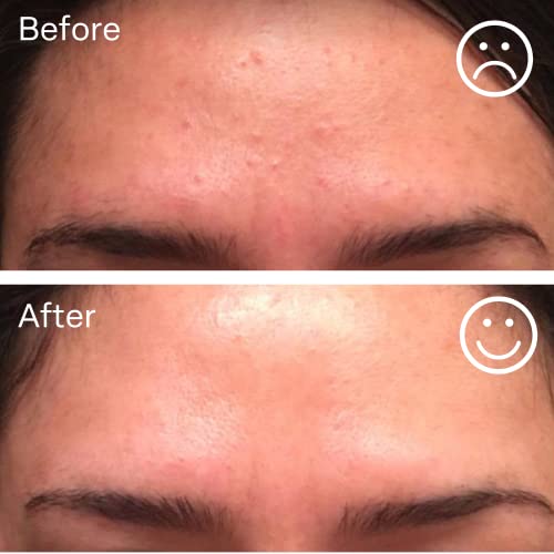 Hyaluronic Acid Serum with Vitamin B5 for Deep Hydration & Skin Plumping