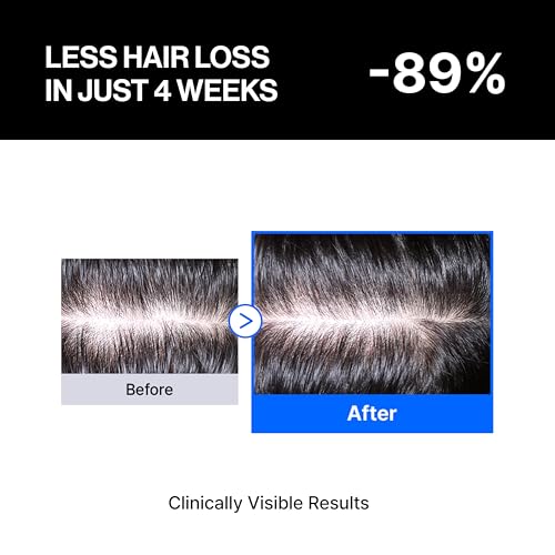 Hair Growth Serum for Hairline & Crown - Targeted Spot Treatment with cADPR Technology