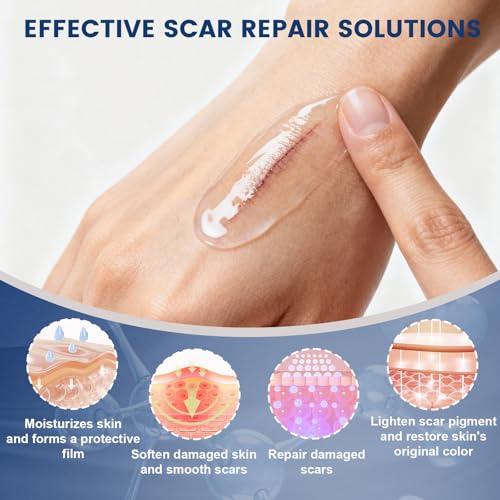 Silicone Scar Gel for Old & New Scars - 50ML Advanced Scar Removal Treatment