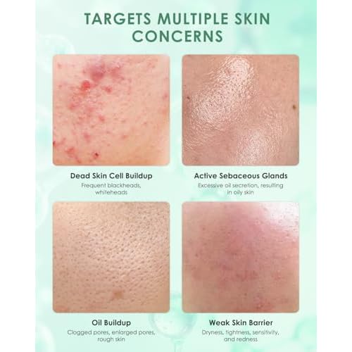 KOMFYMED Rare Ginsenoside Soothing Single Use Essence,Seven-Acid, Lactoferrin, Controls Oil,Repairs & Soothes,Targets Oily 0.05 fl.oz ¡¿30