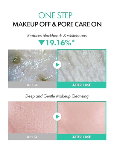 Deep Cleansing Oil for Face with Green Acid & Jojoba | Pore & Makeup Remover