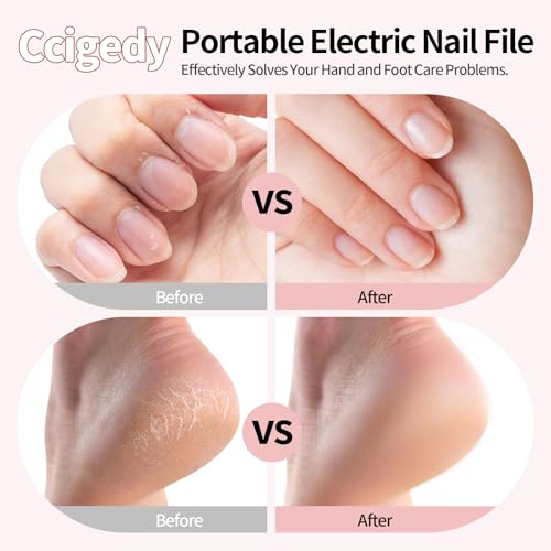 Electric Nail Drill Kit, Nail Filer Electric with LCD & Lamp, Rechargeable Pedicure Tools for Feet, Toenail Grinder for Thick Toenails, Cordless Nail Dremel Tools for Women & Men