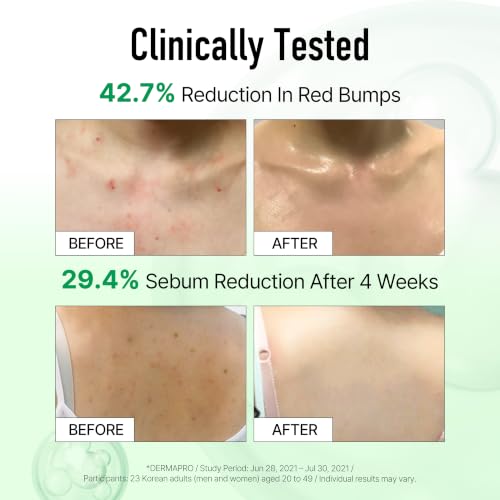 pH Balanced Body Mist with Centella & Hyaluronic Acid – Hydrating Exfoliating Spray for Sensitive Skin
