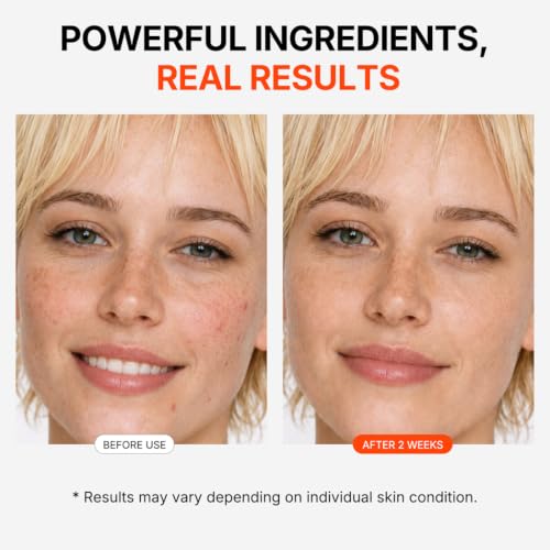 Sulfur Oat Serum with 2% Niacinamide for Oil Control & Sensitive Skin - 1.69 Fl Oz