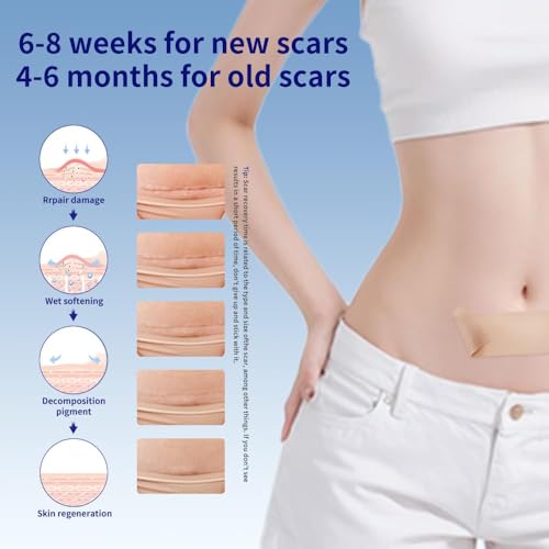 Silicone Scar Sheets 1.6"x59" Roll-1.5M Scars Removal Treatment Medical Grade Silicone Scar Tape for Skin Resuable Strip for Tummy Tuck,Incision,Keloid,C-Section,Burn,Acne Scars
