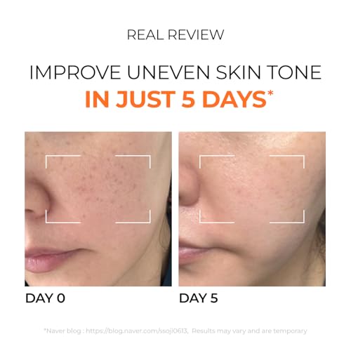 Hyper P-Toning Serum for Brightening & Dark Spot Reduction - 30ml
