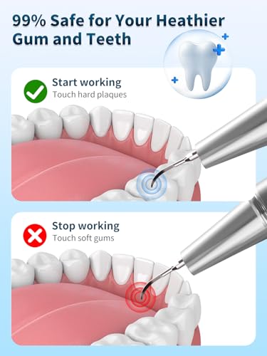 Electric Teeth Plaque Remover Kit with LED Light & 5 Modes - Tartar & Dental Cleaning Tool