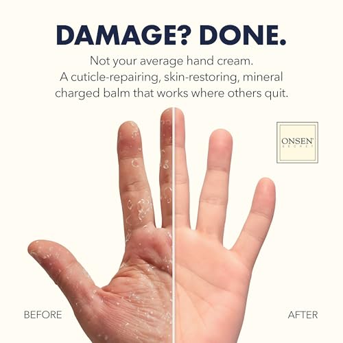 ONSEN 2.93 oz Nail Reboot Kit with Hand & Cuticle Rescue Cream, Buffing Block & Files