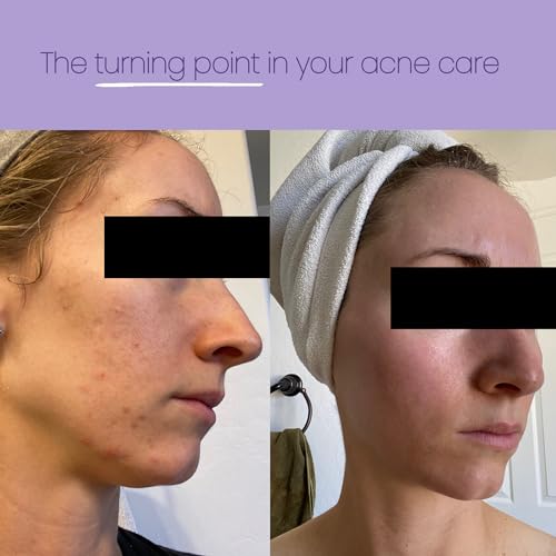 Disposable Face Towels XL, Makeup Remover Cleansing Wipes, 100% Natural Eucalyptus Fiber, Unscented Facial Wash Cloth, 50 count