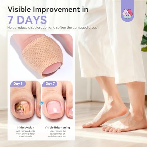 Fungal Nail Patches with 1% Tolnaftate - Overnight Nail Repair (64 Pieces)