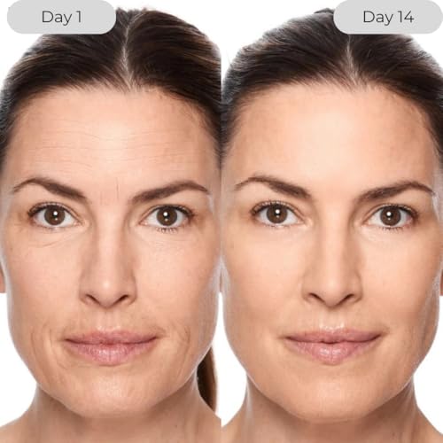 Face Serum with Niacinamide, Vitamin C & E - Nourishing Skin Care 1 fl oz