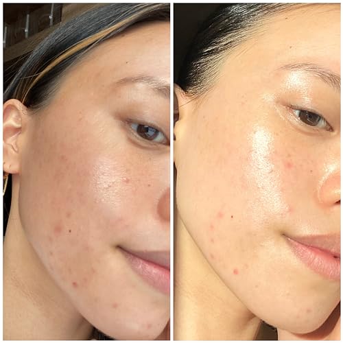 Sand & Sky Face Mask Hydrating Skincare with Hyaluronic Acid - Tasmanian Spring Water Intense Hydration Facial Mask, Skin Barrier Repair, Soothes Redness, Anti Aging Sleeping Mask, Australian Beauty