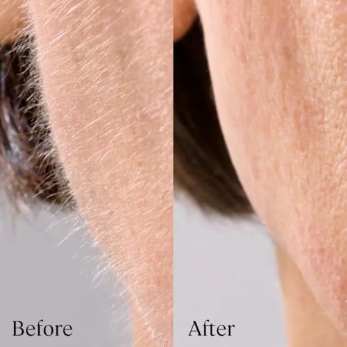 Michael Todd Beauty - Sonicsmooth Pro+ Dermaplaning Blade Refills - 8 Dermaplaning Blades- 2 Month Supply - Device Not Included