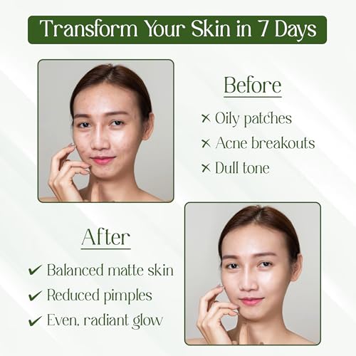 Charm N Glam Face Cleanser(Face wash) |with Neem,Tulsi,Tea Tree |For Dry, Oily & Acne Prone Skin|Deeply Cleanses | Exfoliates Skin| For Men & Women | Sulphate Free | 200ML