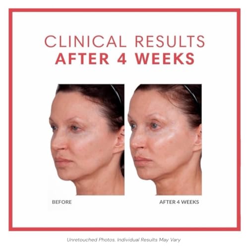 Collagen Eye Cream for Hydration and Firming - 0.5 oz