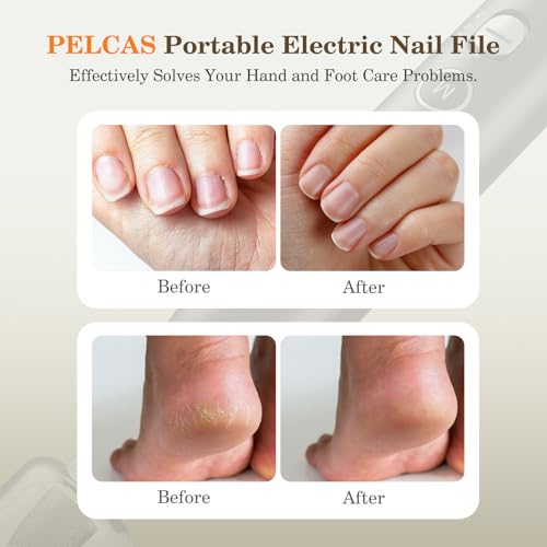 PELCAS Grey Electric Nail Grinder with 10 Speeds & LED Light, Cordless & Rechargeable