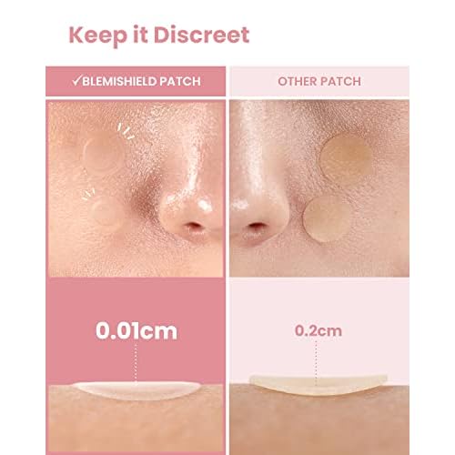 GLAM UP Hydrocolloid Blemish Pimple Zit Patches(180PCS/2Size) - Invisible Ultra Thin Spot Cover Stickers for Face and Skin, Strong Water-proof and Adhesive Overnight, Vegan-friendly