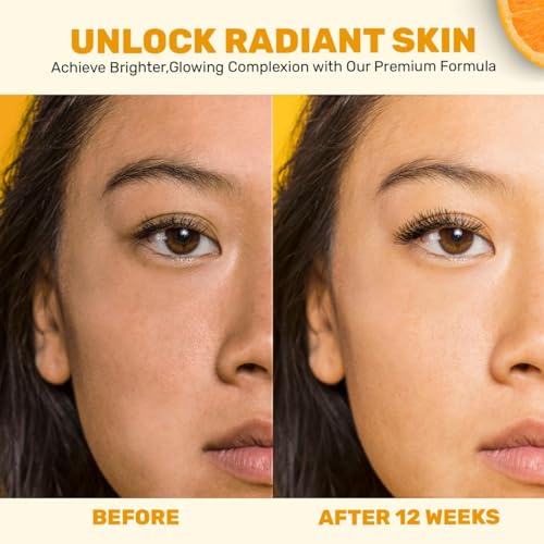 Gentle Vitamin C Serum ? Brightening & Hydrating with Citrus Stem Cells and Chamomile, Safe for Rosacea & Sensitive Skin, 1oz