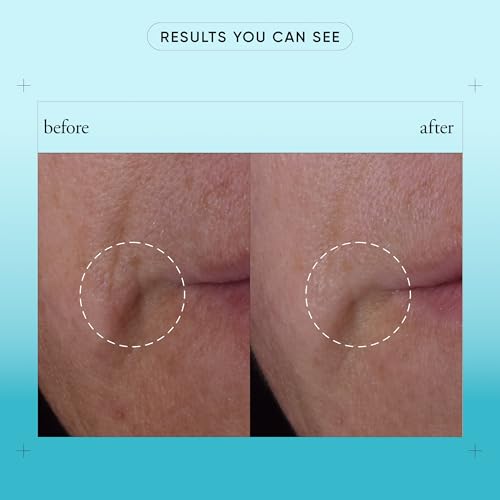 1 Ounce Facial Serum for Bouncy, Radiant Skin with Hyaluronic Acid & Vitamin C - Reactivating Skin Care