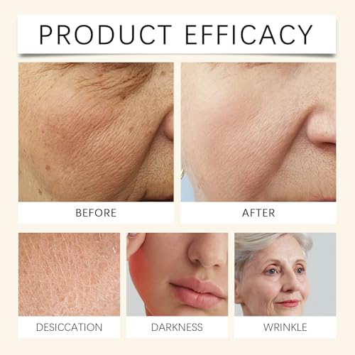 Trilogy Certified Organic Rosehip Oil, Intensive Nourishment, Improves Appearance of Scars, Stretch Marks, Fine Lines, & Wrinkles, 0.34 fl oz