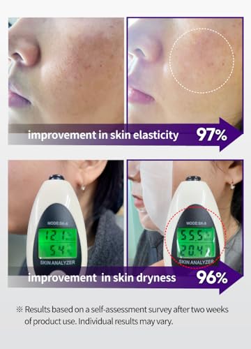 Hydrating & Firming Collagen Sheet Mask - 31 Count Facial Masks for All Skin Types