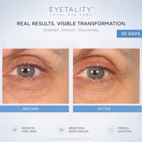 Serious Skincare Eyetality Morning Eye Cream for Dark Circles & Puffiness