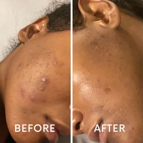 Hydrating Face Moisturizer with Hyaluronic Acid and Aloe ? Lightweight Daily Facial Cream for Dry, Oily, Combination, Mature & Sensitive Skin ? Nourishing, Non-Greasy, Fast-Absorbing ? 2 oz