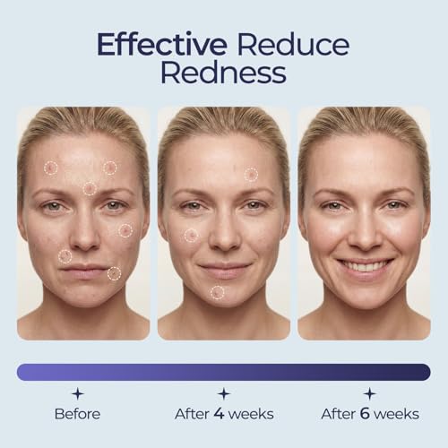 ECOLOOK Disposable Face Towel XL-10"x12" Upgraded Thick Facial Towels, Ultra Soft Clean Face Towels Disposable, 60 Count & 90 GSM, Ideal for Sensitive Skin-2 PACK