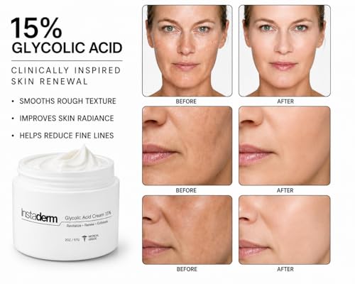 Glycolic Acid 15% Anti-Aging Wrinkle & Dark Spot Corrector - Exfoliates & Refines Skin