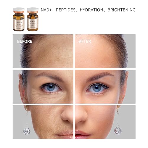 NAD+ 20000PPM Peptide Serum for Microneedling - Freshly Activated 0.68 Fl Oz