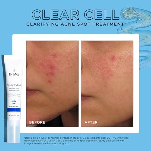 IMAGE Skincare, CLEAR CELL Clarifying Acne Spot Treatment, with Salicylic Acid, Targets Existing Acne Blemishes while Preventing New Blemishes from Forming, 0.5 oz