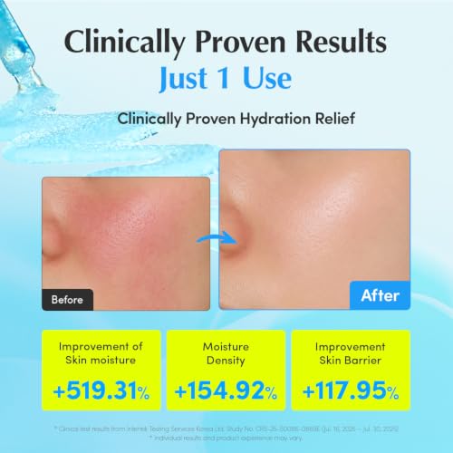 Hydrating Face Serum with Hyaluronic Acid & Ceramides - Redness Relief & Cooling Care, 1oz
