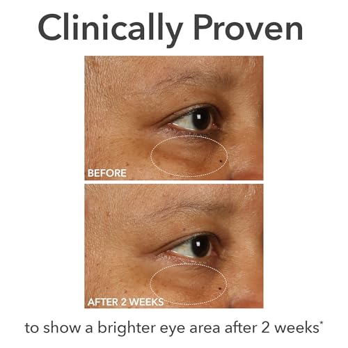 Dr Dennis Gross DermInfusions Fill + Repair Eye Cream: Hydrating & Brightening Treatment for Dark Circles, Fine Lines & Wrinkles, Firms & Smooths 360¡Æ Eye Area, 0.5 Oz