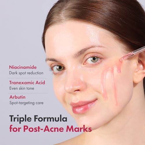 Niacinamide 10% + Tranexamic Acid 4% Serum for Brightening & Pore Care