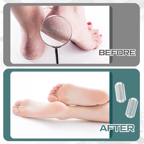 14 Pack Silver Foot File Pedicure Tool Set - Rustproof Callus Remover