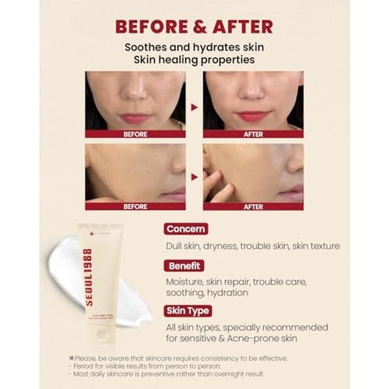 K-SECRET SEOUL 1988 Snail Mucin 93% Cream ? Concentrated Yet Lightweight Formula Infused with 93% Snail Mucin | Non-Sticky & Fast-Absorption Facial Cream | Korean Skincare, 100ml / 3.38 fl oz
