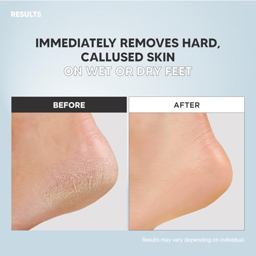 F3 Systems S-Line Pedicure Set with Foot File & Foot Spray - Callus Remover, Cracked Heel Treatment, Ergonomic Design, Double-Sided Foot Tool