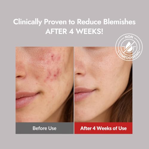 Blemish Control Toner with Salicylic Acid & Tea Tree - 4.05 fl oz