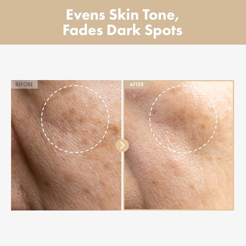 Rice Glow Milky Toner for Glass Skin & Hydration - Gentle, Fragrance-Free