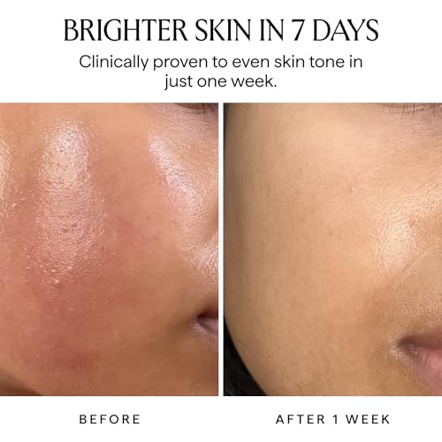 HERBIVORE Nova 15% Vitamin C + Turmeric Brightening Serum for Dark Spots, Hyperpigmentation + Even Skin Tone | Vegan, Plant-Based, Cruelty-Free, 30 mL / 1 oz
