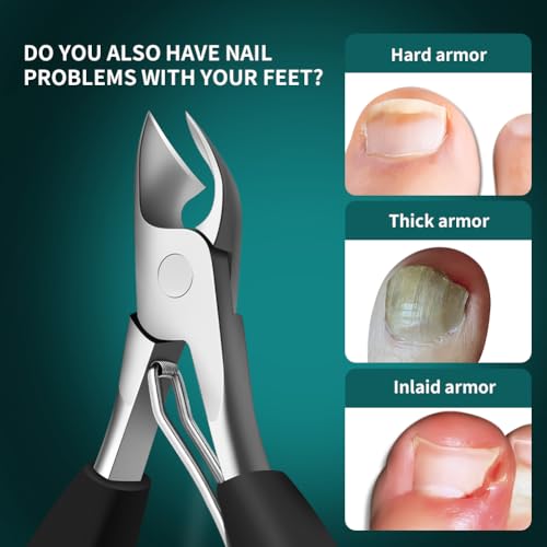 DEOU Heavy Duty Large Opening toenail Clippers, Suitable for Embedded Growth and Rough Nails, Home Pedicure Tools for Men, Women, Elderly Newly Upgraded Stainless Steel (Nail Clippers+Gift Box)