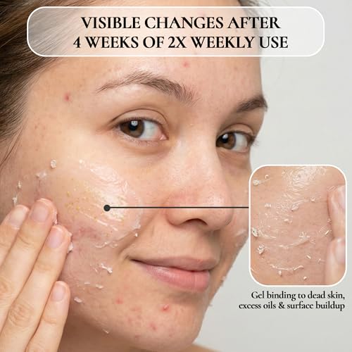 Vivo Per Lei Facial Peeling Gel - Helps Address Dead Skin Buildup - Gentle Exfoliating Gel for Rough, Dry, Sensitive or Mature Skin - Face and Body Scrub - Non Abrasive - 4.05 Fl. Oz. - Pack of 4