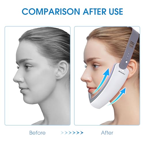 V Face Double Chin Reduction Device with Remote Control for Women