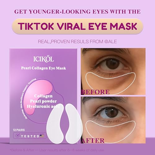 Hyaluronic Acid Collagen Under Eye Patches - 12 Pairs Deep Hydrating Eye Mask for Puffiness & Dark Circles - All-Day Moisture