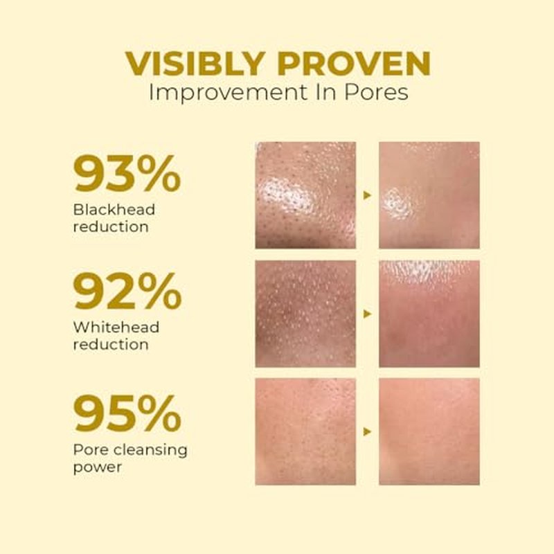 Conscious Chemist Makeup Remover & Oil Cleanser | 130ml | Face Wash & Cleanser for Oily Skin | Removes Waterproof Makeup, Blackheads & Whiteheads | Soft & Clear Skin - Daily Dissolve